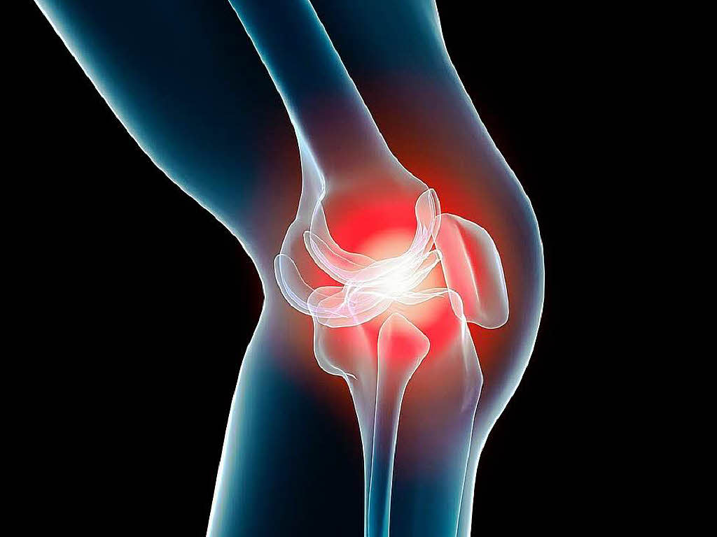 Quelles sont les causes de l’arthrite?